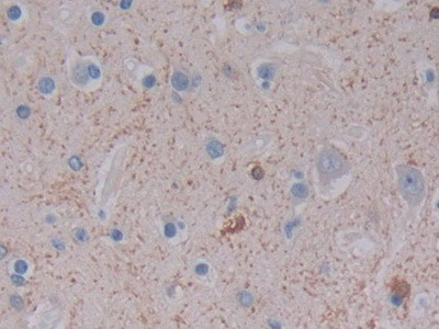 Ferritin Light Chain Antibody in Immunohistochemistry (Paraffin) (IHC (P))