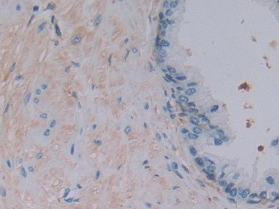 Ferritin Light Chain Antibody in Immunohistochemistry (Paraffin) (IHC (P))