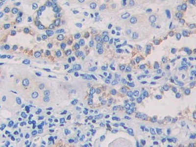 EB1 Antibody in Immunohistochemistry (Paraffin) (IHC (P))