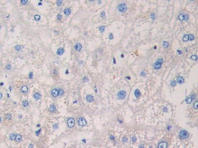 EB1 Antibody in Immunohistochemistry (Paraffin) (IHC (P))