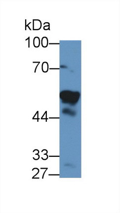 NAMPT Antibody in Western Blot (WB)