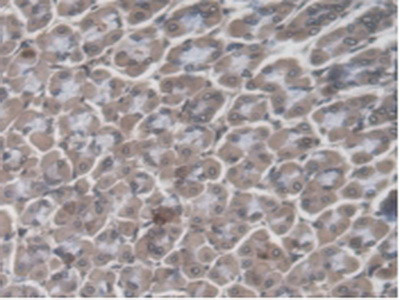 GBP4 Antibody in Immunohistochemistry (Paraffin) (IHC (P))