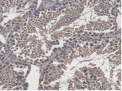 GBP4 Antibody in Immunohistochemistry (Paraffin) (IHC (P))