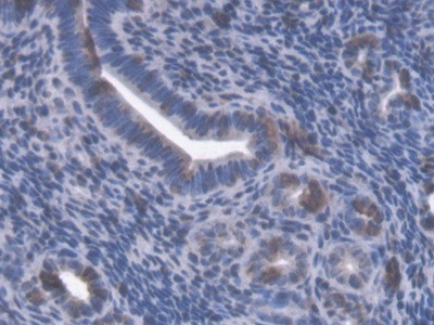 GBP4 Antibody in Immunohistochemistry (Paraffin) (IHC (P))