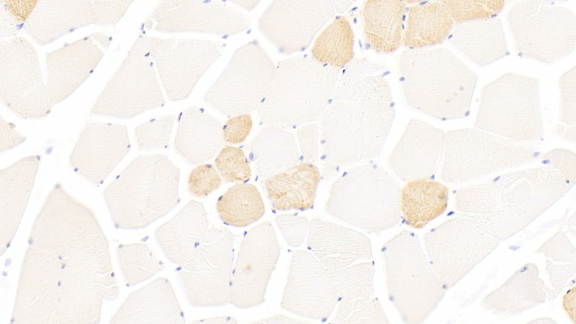 Myosin heavy chain 1 Antibody in Immunohistochemistry (Paraffin) (IHC (P))