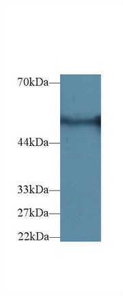 G6PD Antibody in Western Blot (WB)