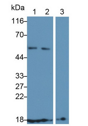 CD59 Antibody in Western Blot (WB)