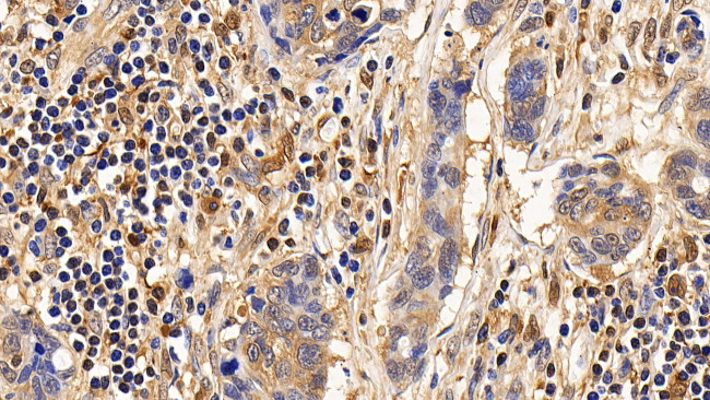 IL13RA2 Antibody in Immunohistochemistry (Paraffin) (IHC (P))