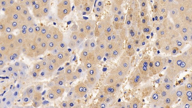 IL13RA2 Antibody in Immunohistochemistry (Paraffin) (IHC (P))