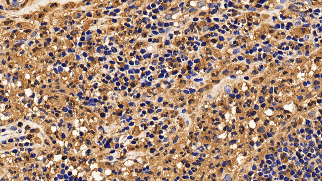 IL13RA2 Antibody in Immunohistochemistry (Paraffin) (IHC (P))