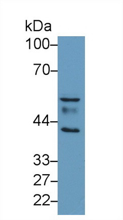 IL13RA2 Antibody in Western Blot (WB)