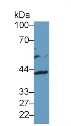 IL13RA2 Antibody in Western Blot (WB)