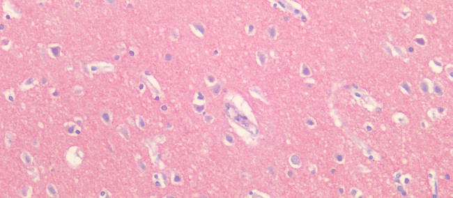 BACE2 Antibody in Immunohistochemistry (Paraffin) (IHC (P))