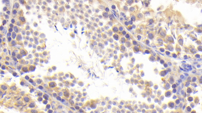 BACE2 Antibody in Immunohistochemistry (Paraffin) (IHC (P))