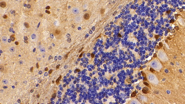 S100B Antibody in Immunohistochemistry (Paraffin) (IHC (P))