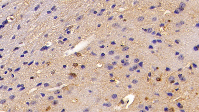 S100B Antibody in Immunohistochemistry (Paraffin) (IHC (P))