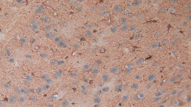 S100B Antibody in Immunohistochemistry (Paraffin) (IHC (P))