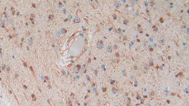 S100B Antibody in Immunohistochemistry (Paraffin) (IHC (P))