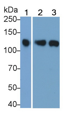 JAK3 Antibody in Western Blot (WB)