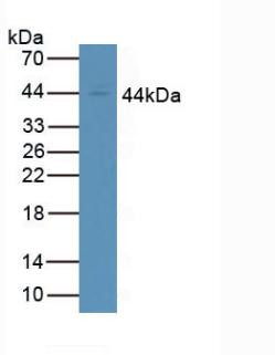 CD64 Antibody in Western Blot (WB)