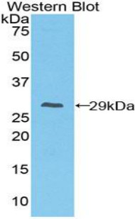 CD64 Antibody in Western Blot (WB)