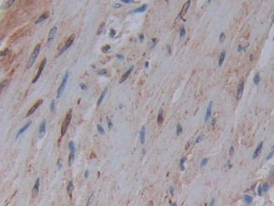 COX1 Antibody in Immunohistochemistry (Paraffin) (IHC (P))