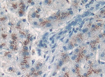 C20orf10 Antibody in Immunohistochemistry (Paraffin) (IHC (P))