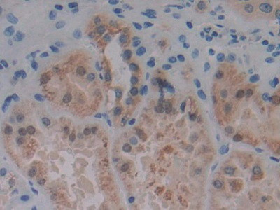 PKC mu Antibody in Immunohistochemistry (Paraffin) (IHC (P))