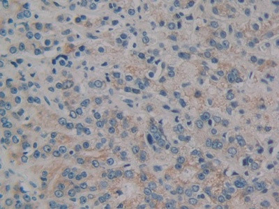 PKC mu Antibody in Immunohistochemistry (Paraffin) (IHC (P))