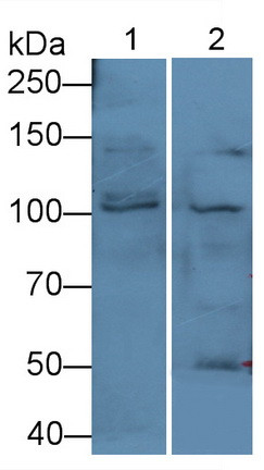 PKC mu Antibody in Western Blot (WB)