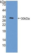 PKC mu Antibody in Western Blot (WB)