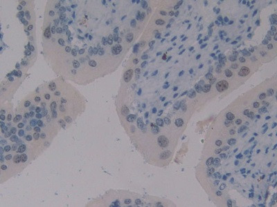 ELOA Antibody in Immunohistochemistry (Paraffin) (IHC (P))