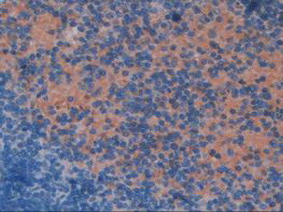 ELOA Antibody in Immunohistochemistry (Paraffin) (IHC (P))