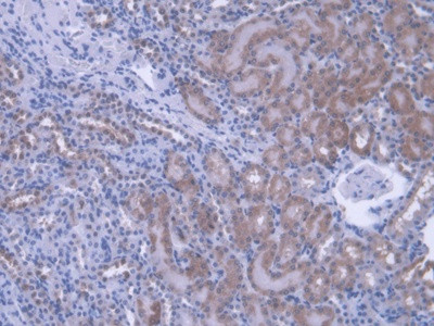 PEBP1 Antibody in Immunohistochemistry (Paraffin) (IHC (P))