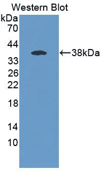 ABHD7 Antibody in Western Blot (WB)