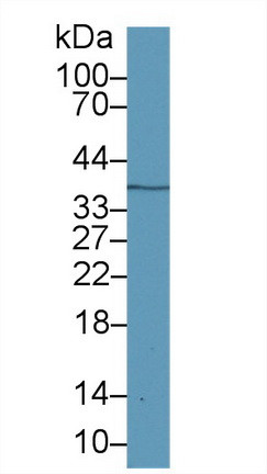 Galectin 12 Antibody in Western Blot (WB)