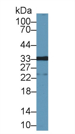 Galectin 12 Antibody in Western Blot (WB)