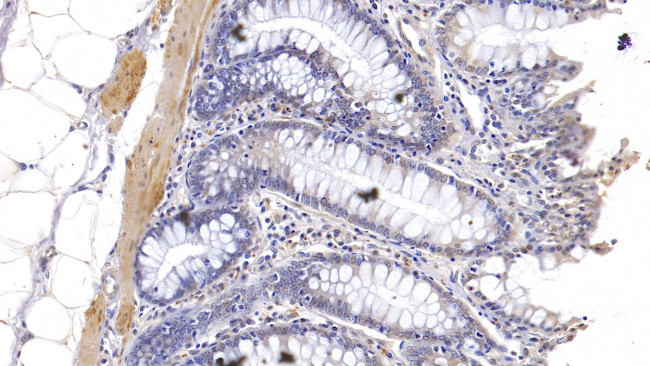 KPNA3 Antibody in Immunohistochemistry (Paraffin) (IHC (P))