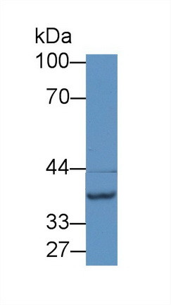 NAT2 Antibody in Western Blot (WB)