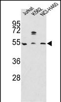 Apolipoprotein A4 Antibody in Western Blot (WB)