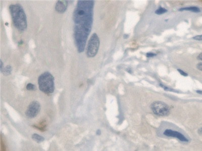 SERPINB3/SERPINB4 Antibody in Immunohistochemistry (Paraffin) (IHC (P))