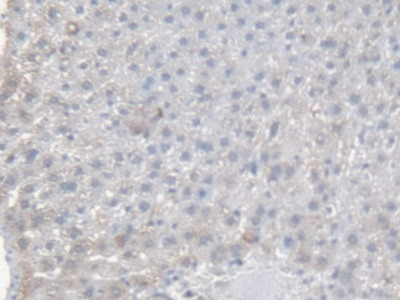 CES1 Antibody in Immunohistochemistry (Paraffin) (IHC (P))