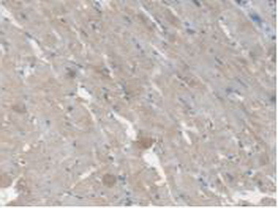 CES1 Antibody in Immunohistochemistry (Paraffin) (IHC (P))