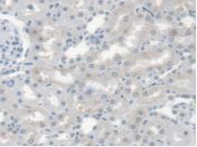 CES1 Antibody in Immunohistochemistry (Paraffin) (IHC (P))