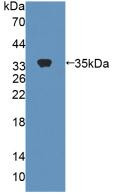 CES1 Antibody in Western Blot (WB)