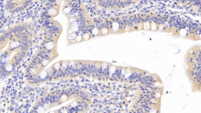 HFE2 Antibody in Immunohistochemistry (Paraffin) (IHC (P))