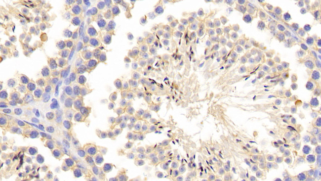 MMP1 Antibody in Immunohistochemistry (Paraffin) (IHC (P))