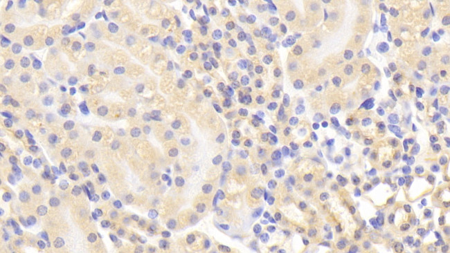 MMP1 Antibody in Immunohistochemistry (Paraffin) (IHC (P))