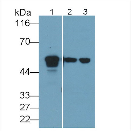 Acid Phosphatase 2 Antibody in Western Blot (WB)