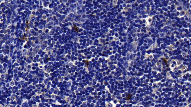 Tryptase Antibody in Immunohistochemistry (Paraffin) (IHC (P))